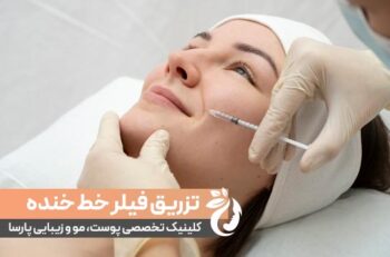 تزریق فیلر خط خنده