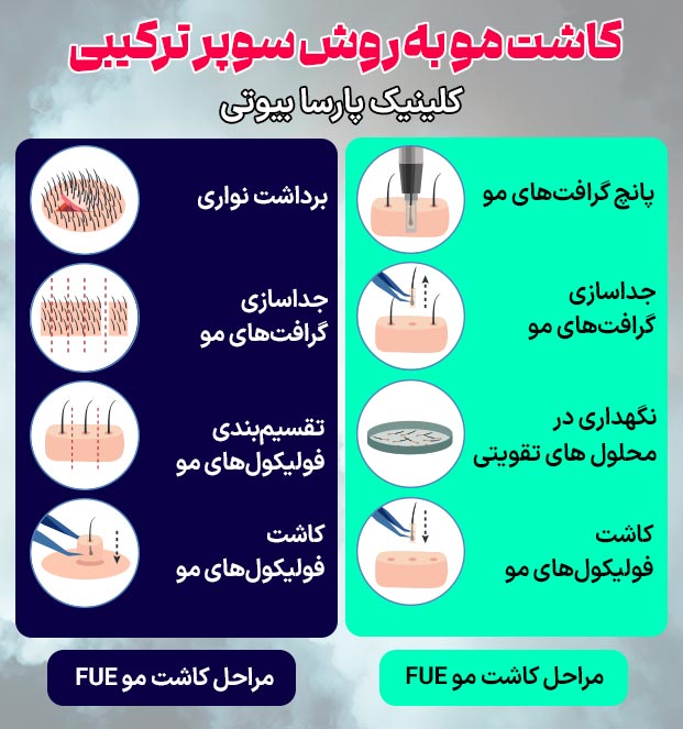 مراحل کاشت مو به روش سوپر ترکیبی