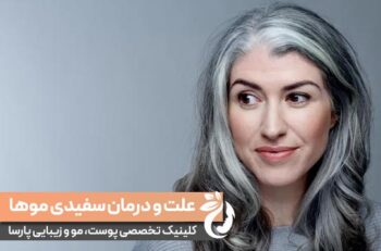 علت سفید شدن موها و راهکارهای درمان آن