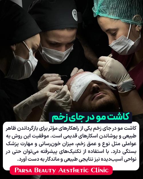 کاشت مو در جای زخم