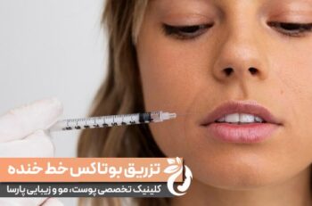 بوتاکس خط خنده | مزایا، ماندگاری، عوارض و هزینه