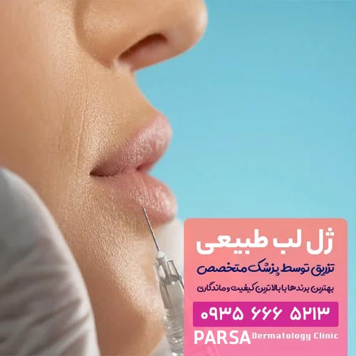 تزریق ژل لب طبیعی