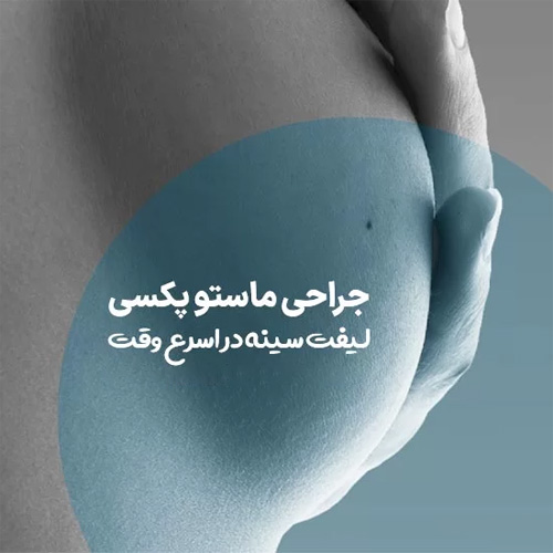 جراحی ماستوپکسی