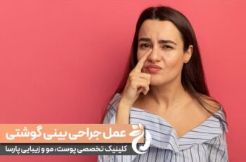 عمل بینی‌ گوشتی چیست و چقدر هزینه دارد ؟