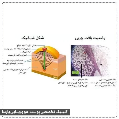 نحوه اثر گذاری بر چربی