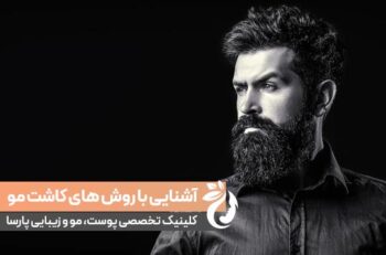 آشنایی با بهترین روش های کاشت مو در ایران