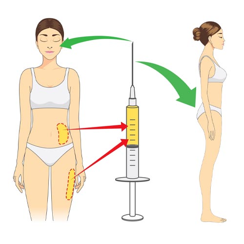 آماده سازی چربی برای تزریق