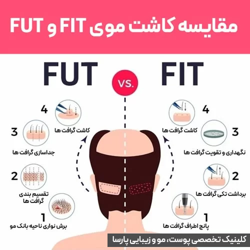 مقایسهFIT