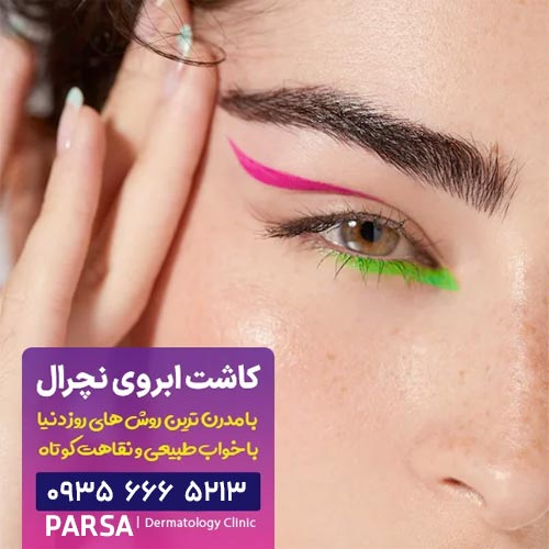 کاشت ابروی نچرال