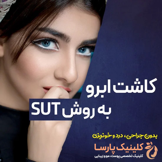 کاشت ابرو به روش SUT