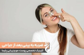 دستکاری و وضربه به بینی بعد از جراحی