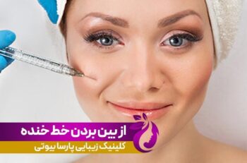 از بین بردن خط خنده