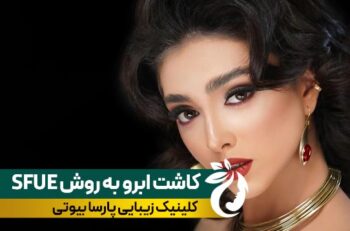 کاشت ابرو به روش SUPER FUE | طراحی مدرن با تراکم حداکثری