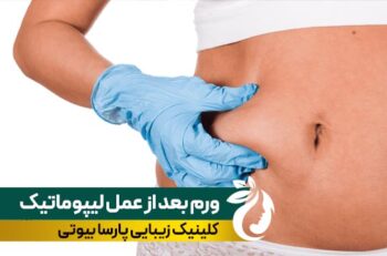 علت و راهکارهای درمان ورم بعد از لیپوماتیک